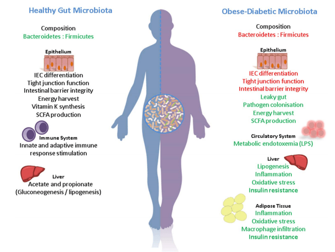 microbiota-obesidad-intestino